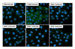 Anti-Chikungunya virus nsP1 antibody [HL2605] used in Immunocytochemistry/ Immunofluorescence (ICC/IF). GTX639057